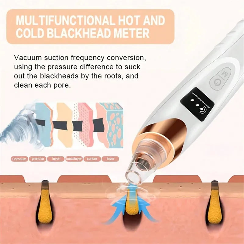 Electric Blackhead Remover Vacuum – Rechargeable Pore Cleaner with 5 Suction Levels for Deep Facial Cleansing