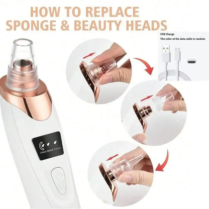 Electric Blackhead Remover Vacuum – Rechargeable Pore Cleaner with 5 Suction Levels for Deep Facial Cleansing